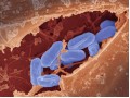 Détails : Quels sont les symptômes d'un microbiote déséquilibré ?